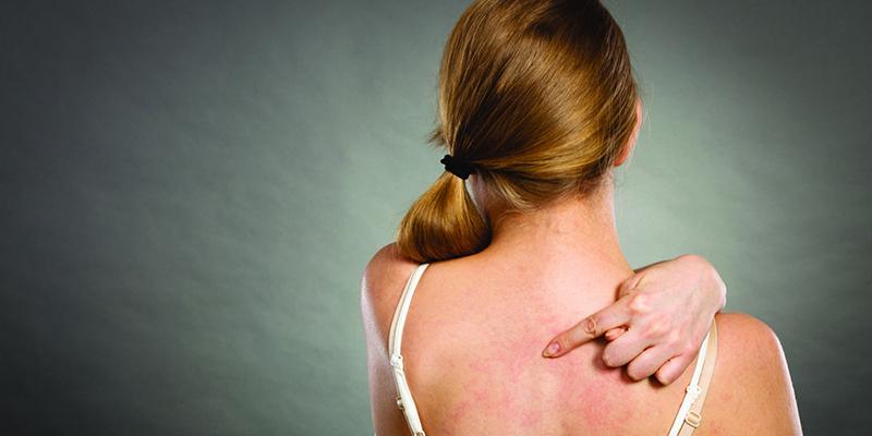 Why Sensitive Skin Can Lead to Recurring Eczema Flare-Ups