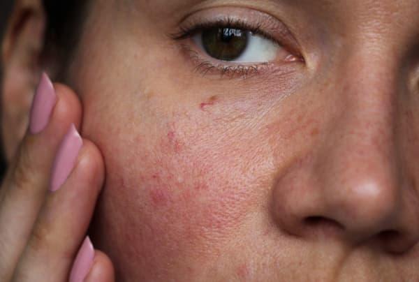 When Dry and Itchy Skin Becomes a Long-Term Problem