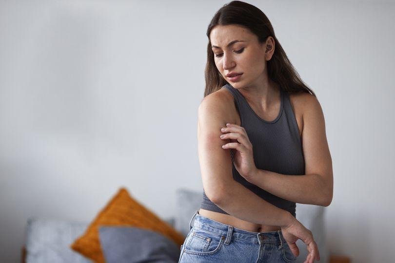Understanding Why Eczema Causes Ongoing Skin Irritation
