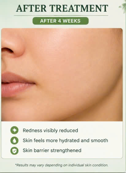 Sau