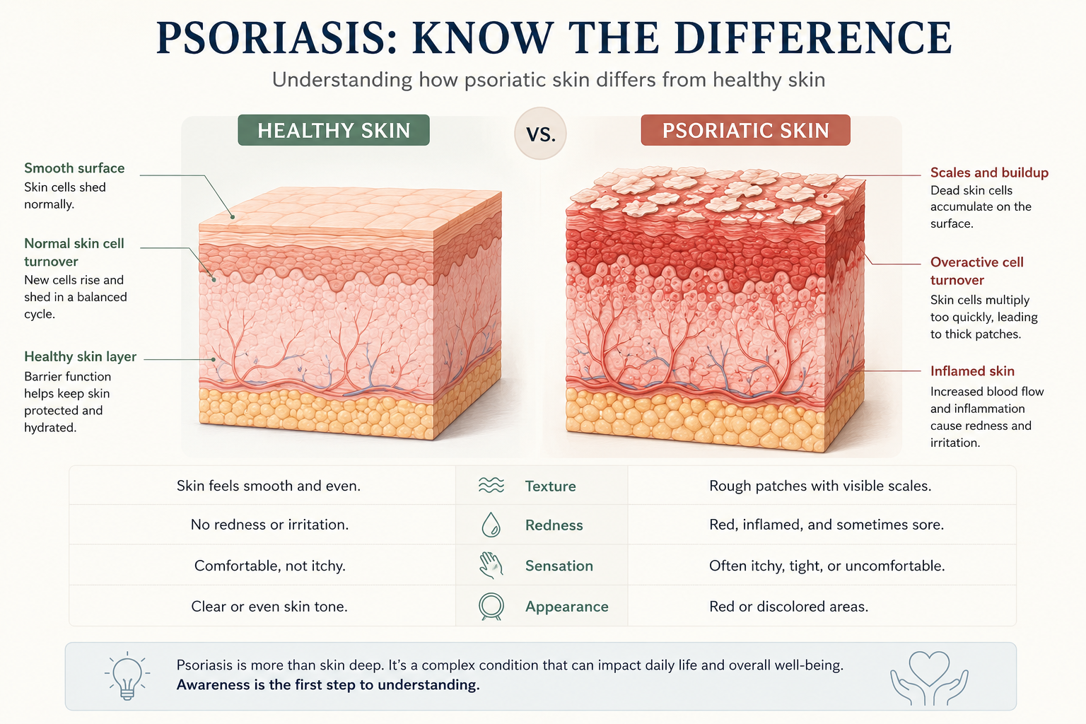 Living With Psoriasis: Understanding a Long-Term Skin Condition