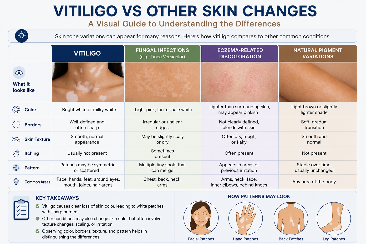 Recognizing Skin Tone Changes: A Closer Look at Vitiligo Patterns